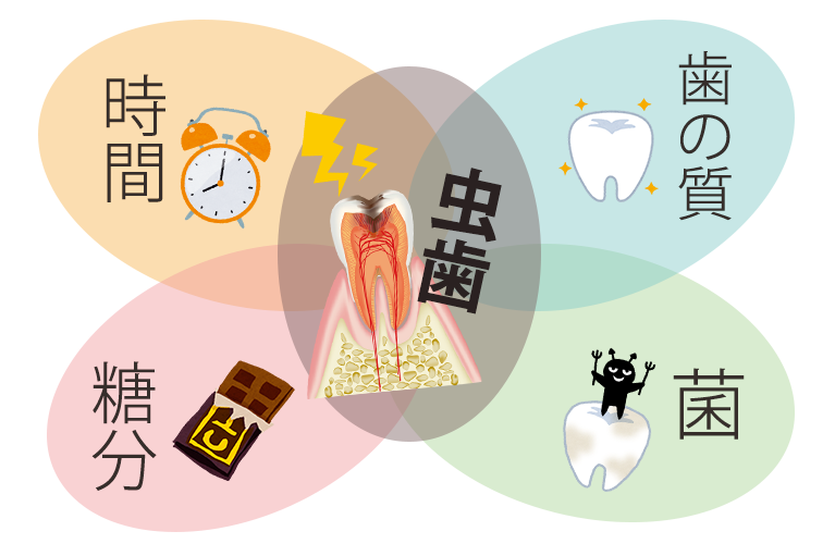 虫歯の原因