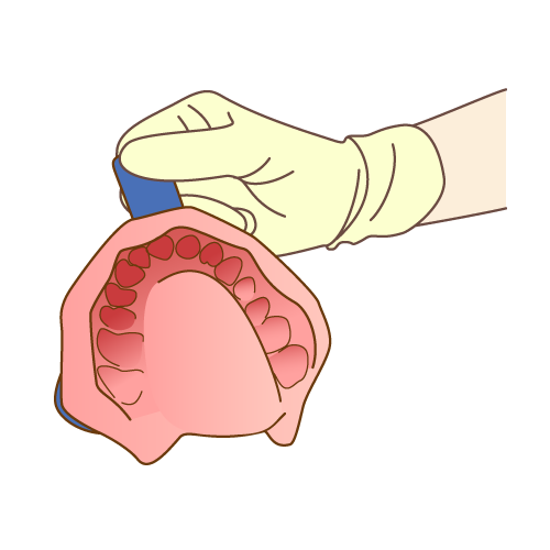 歯型を採りマウストレーを作製