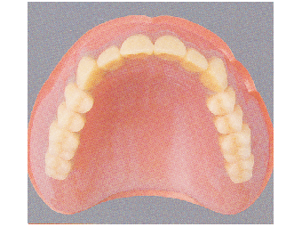 レジン床義歯（健康保険適応）